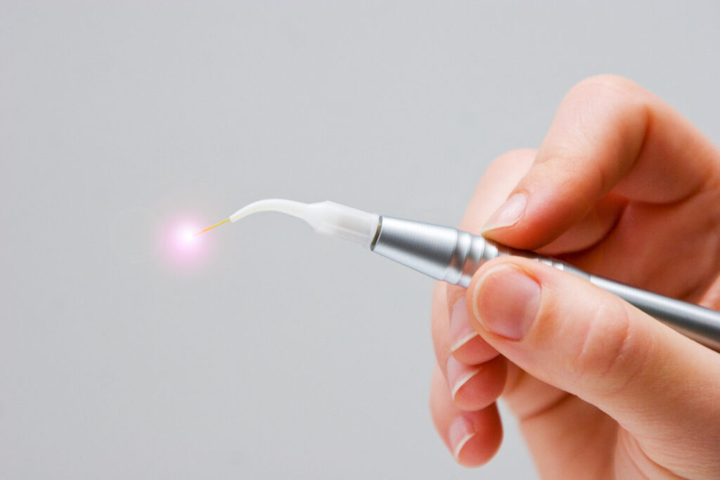 Photo shows a LANAP laser, used for surgery-free gum disease treatments.